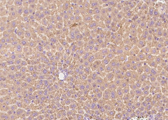 Recombinant Transferrin Receptor/TFRC Monoclonal Antibody-searchlist-1
