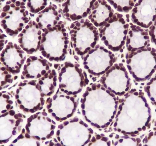 Recombinant MBD2 Monoclonal Antibody - small - 4