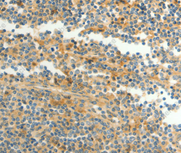 CFHR1 Polyclonal Antibody - 3