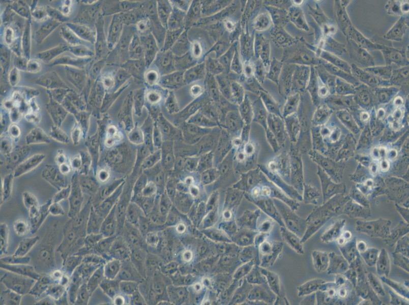 NCI-H1703 Cell Complete Medium - 5