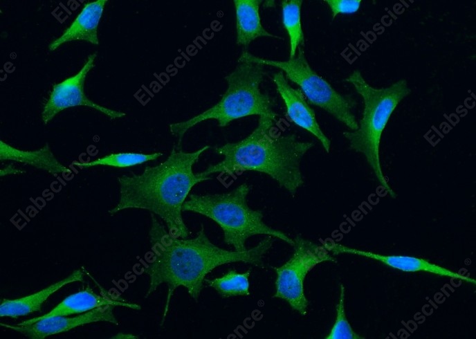 TrkC/NTRK3 Monoclonal Antibody - 1