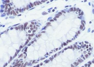 Recombinant SIN3A Monoclonal Antibody-searchlist-2