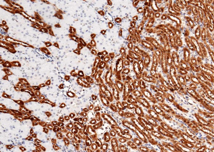 Recombinant Carbonic Anhydrase II/Car2 Monoclonal Antibody - 2