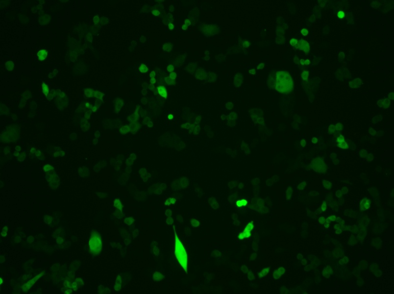 4T1-GFP Cell Complete Medium4T1-GFP Cell Complete Medium - 3