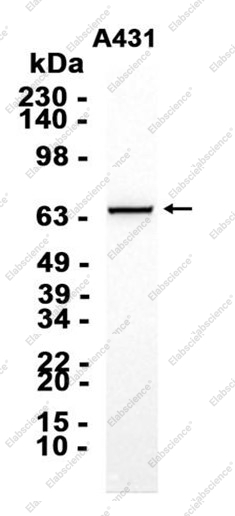 Recombinant IRAK2 Monoclonal Antibody - 1