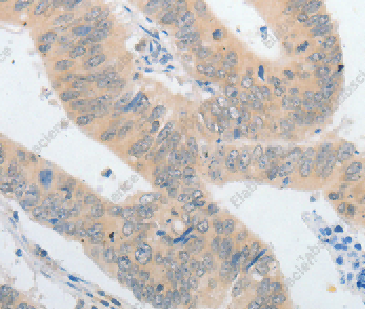 PLPP1 Polyclonal Antibody - 3