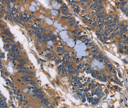 ILK Polyclonal Antibody - 3