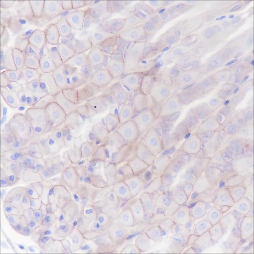Recombinant B7-H3/CD276 Monoclonal Antibody - small - 6
