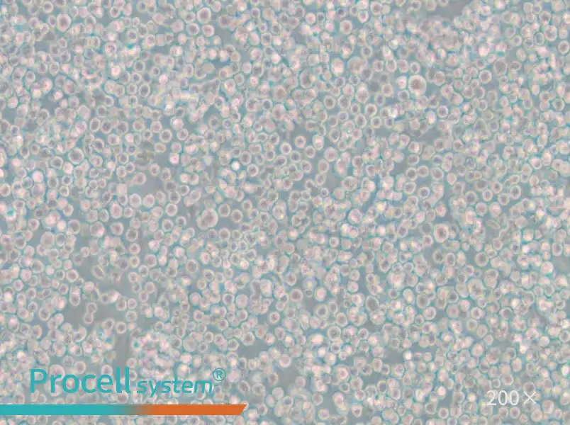 WIL2 S Cell Complete Medium - 6