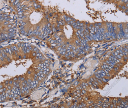 LIMS1 Polyclonal Antibody - 2