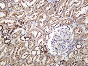 Recombinant FGF7 Monoclonal Antibody - 2