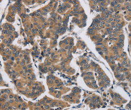 DHRS3 Polyclonal Antibody - 2