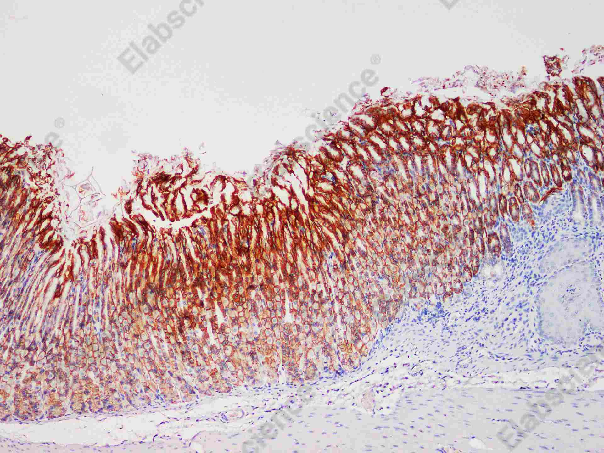 Recombinant Carbonic Anhydrase IX/CA9 Monoclonal Antibody - 1