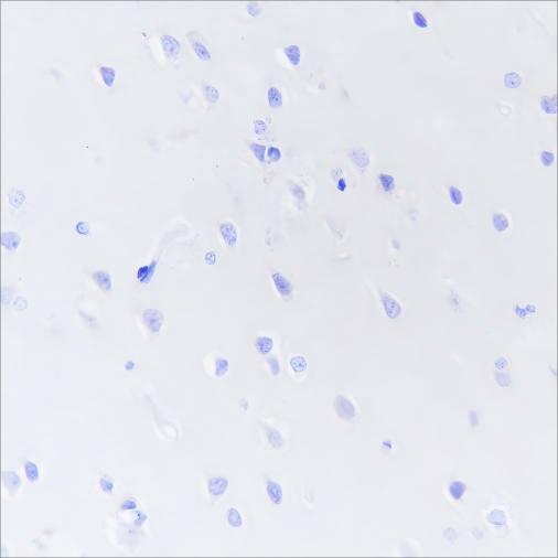 Recombinant DPEP1 Monoclonal Antibody-searchlist-1