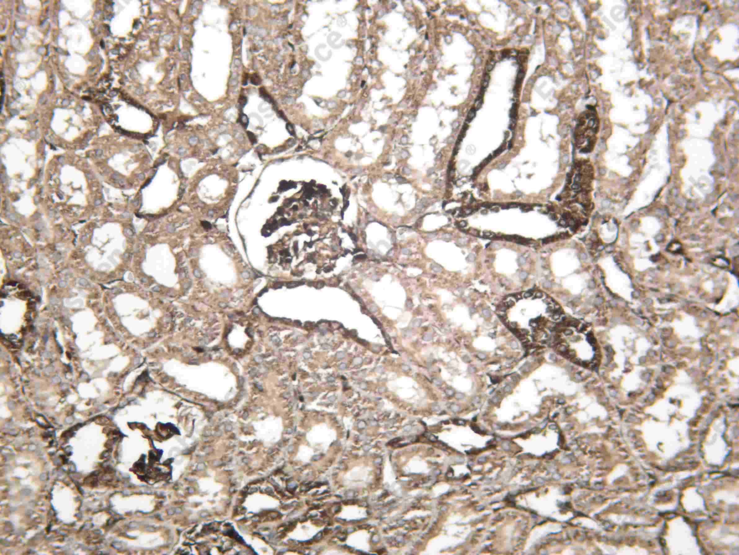 Recombinant SCRB2 Monoclonal Antibody - 4
