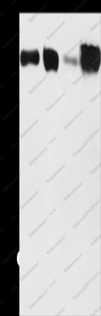 ACSL4 Polyclonal Antibody - 1