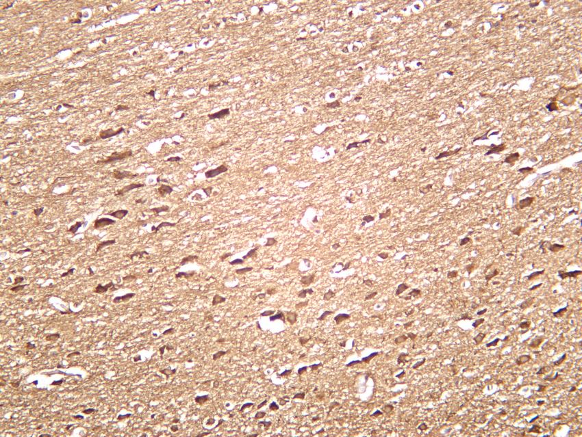 Recombinant LC3B Monoclonal Antibody - small - 4