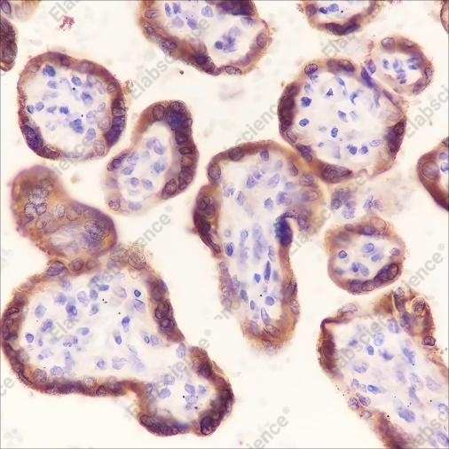 Recombinant Laminin beta 1 Monoclonal Antibody - 1