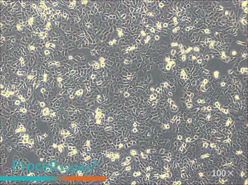 IOMM-Lee Cell Complete Medium - 3