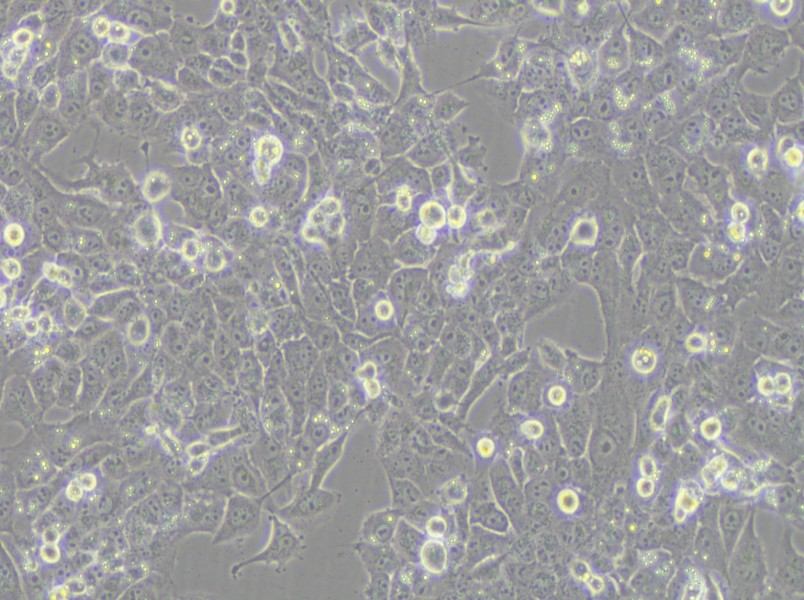 NCI-H1915 Cell Complete Medium - small - 6