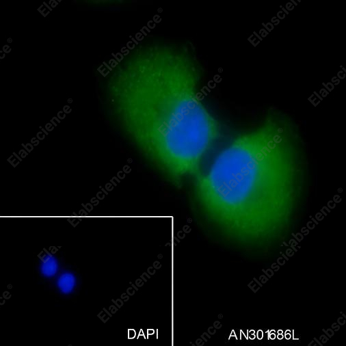 Recombinant Vitronectin/S-Protein Monoclonal Antibody - 3