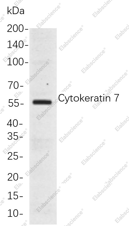 Recombinant Cytokeratin 7 Monoclonal Antibody - 1