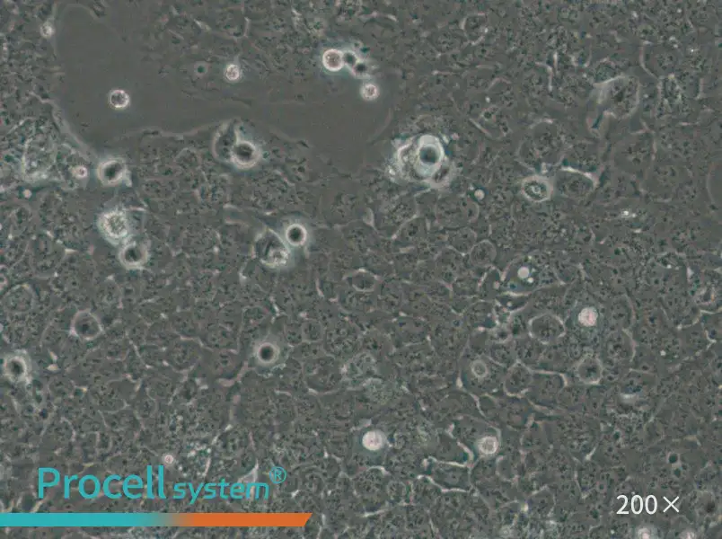 JHH-7 Cell Complete Medium - small - 4