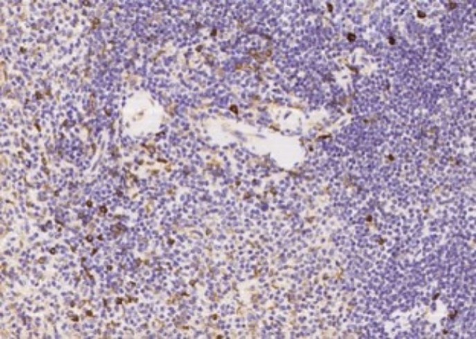 TNFAIP8 Monoclonal Antibody - small - 2