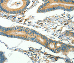 CAV3 Polyclonal Antibody - 3
