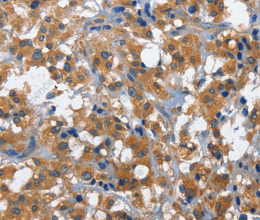 CD27 Polyclonal Antibody - 3