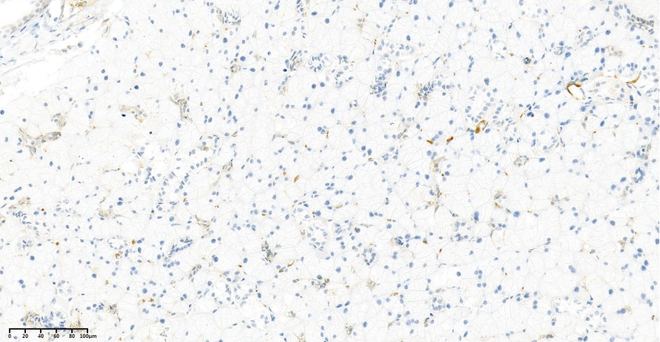 Recombinant EGFR Monoclonal Antibody - small - 2