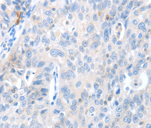 MAGEB4 Polyclonal Antibody - 3