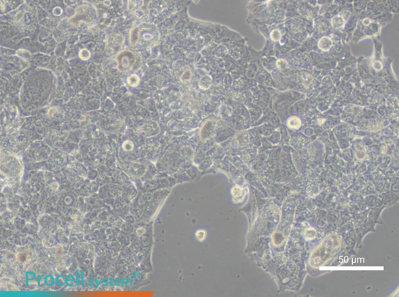 HCC1419 Cell Complete MediumHCC1419 Cell Complete Medium - 6