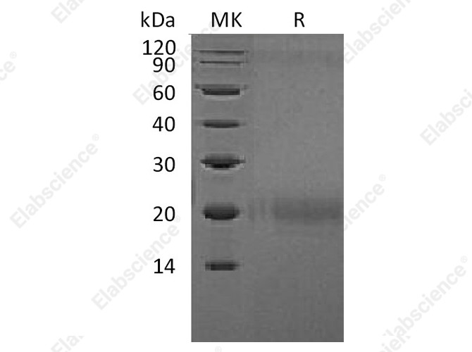 Recombinant Human CTLA4 Protein (Flag Tag) - 1