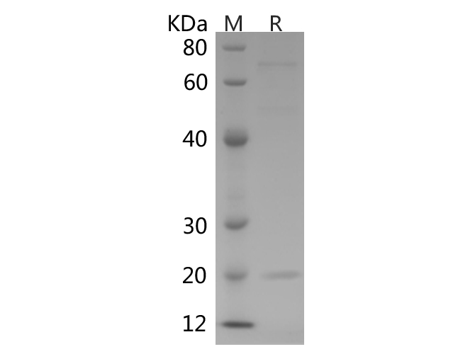Recombinant Human FGF21 Protein (Sumo Tag)-产品推荐-1