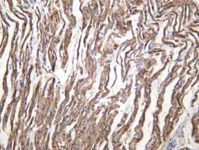 Recombinant Caveolin-3 Monoclonal Antibody - 4