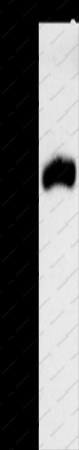 RPAP3 Polyclonal Antibody - 1