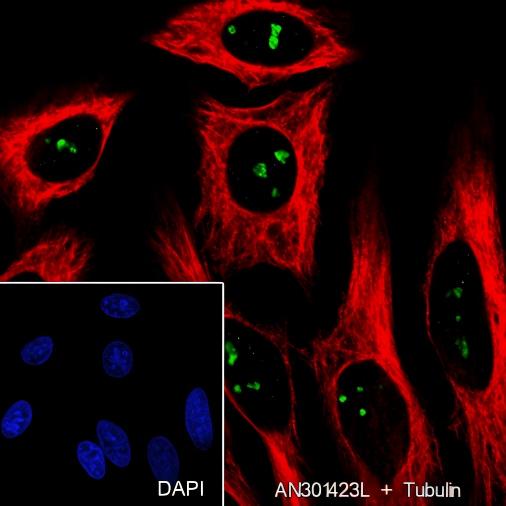 Recombinant AATF Monoclonal Antibody - small - 3