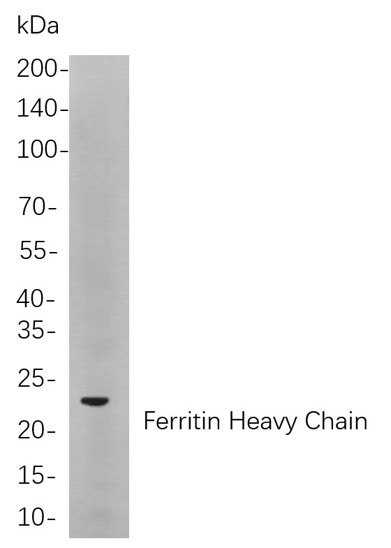 Recombinant Ferritin Heavy Chain Monoclonal Antibody-searchlist-1