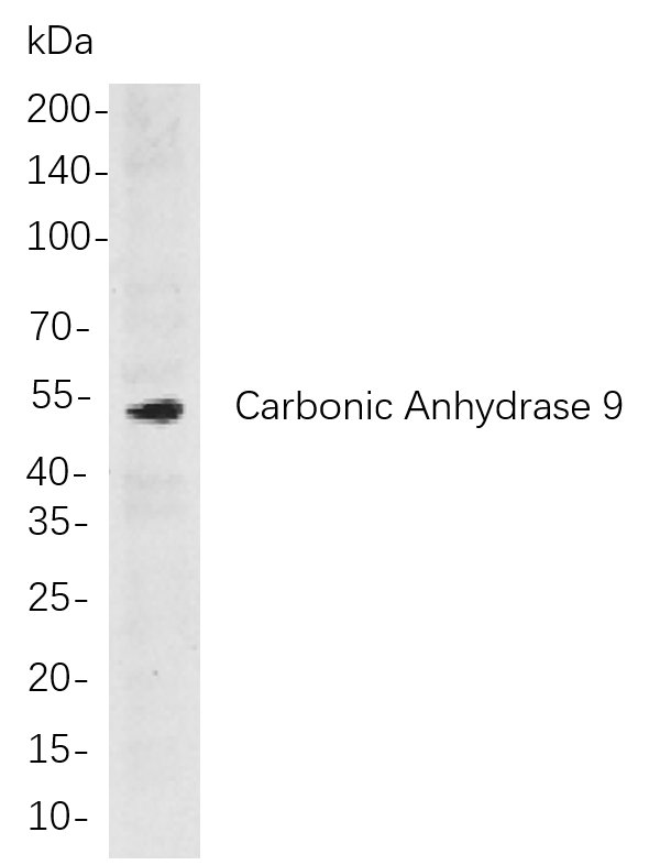 Recombinant Carbonic Anhydrase 9 Monoclonal Antibody-searchlist-1