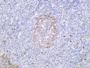 Recombinant AID Monoclonal Antibody - 1