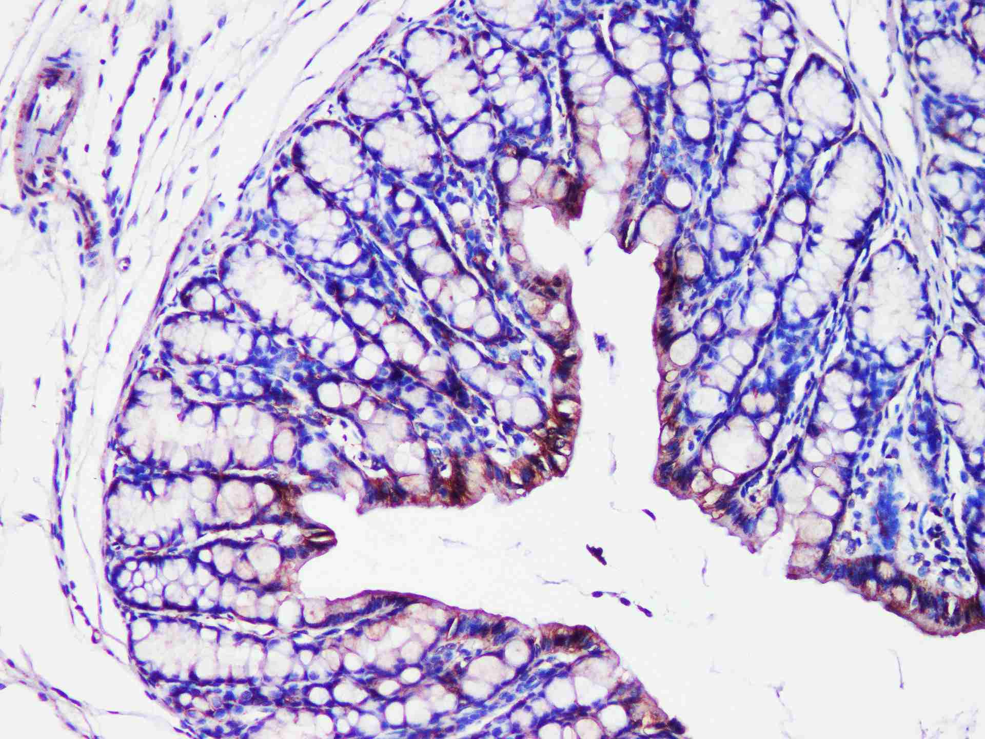 ST14 Polyclonal Antibody - 3