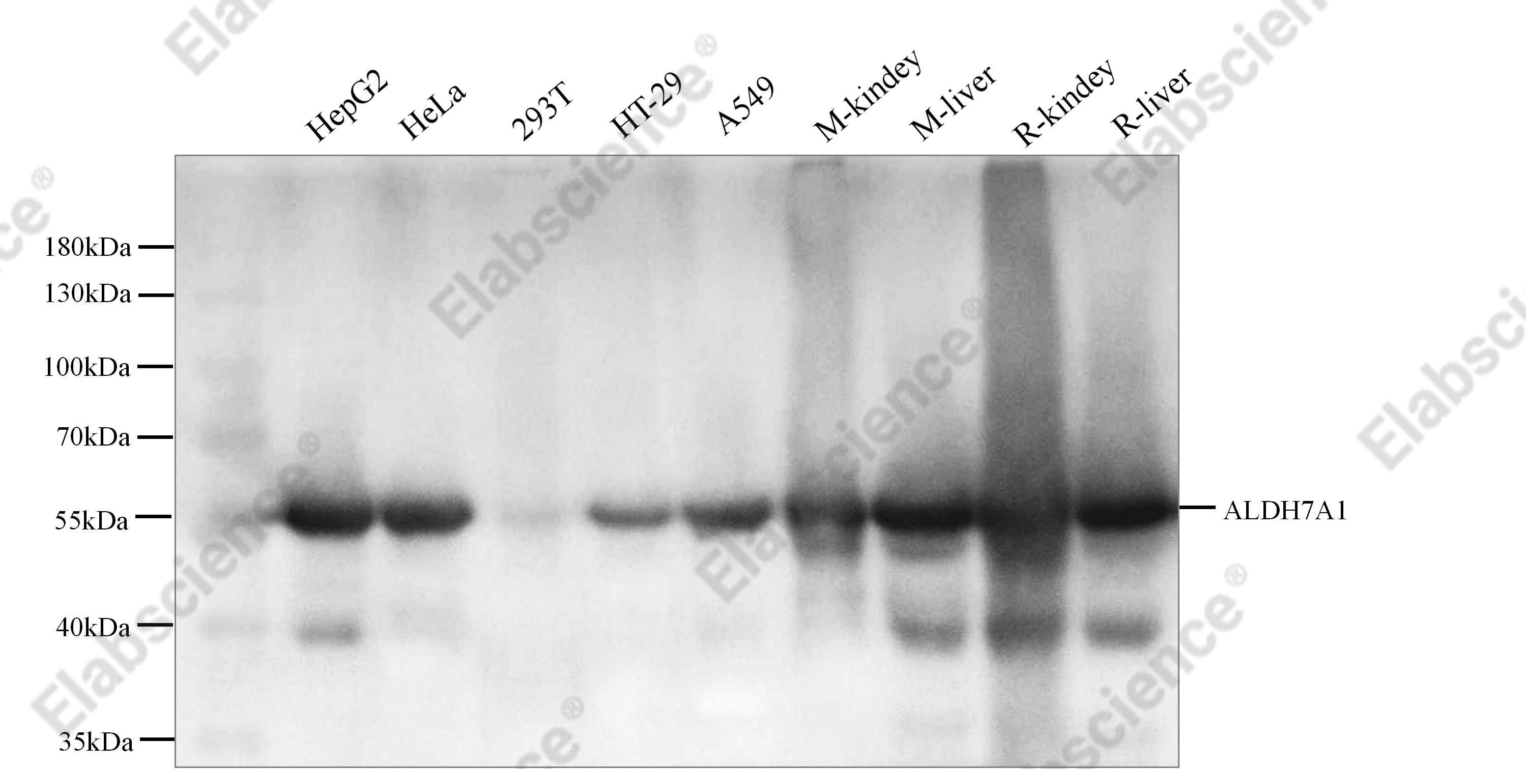 Recombinant ALDH7A1 Monoclonal Antibody - 4