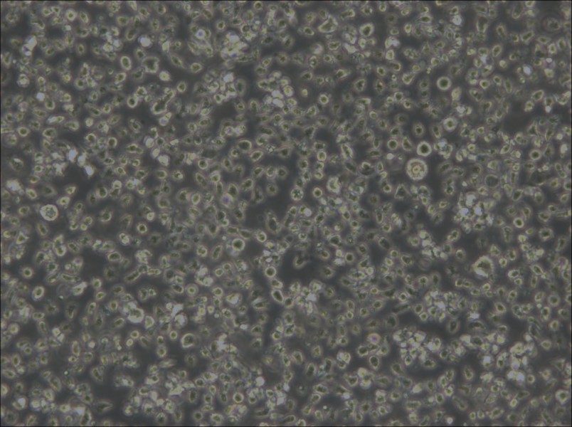 MEC-1 Cell Complete Medium - small - 5