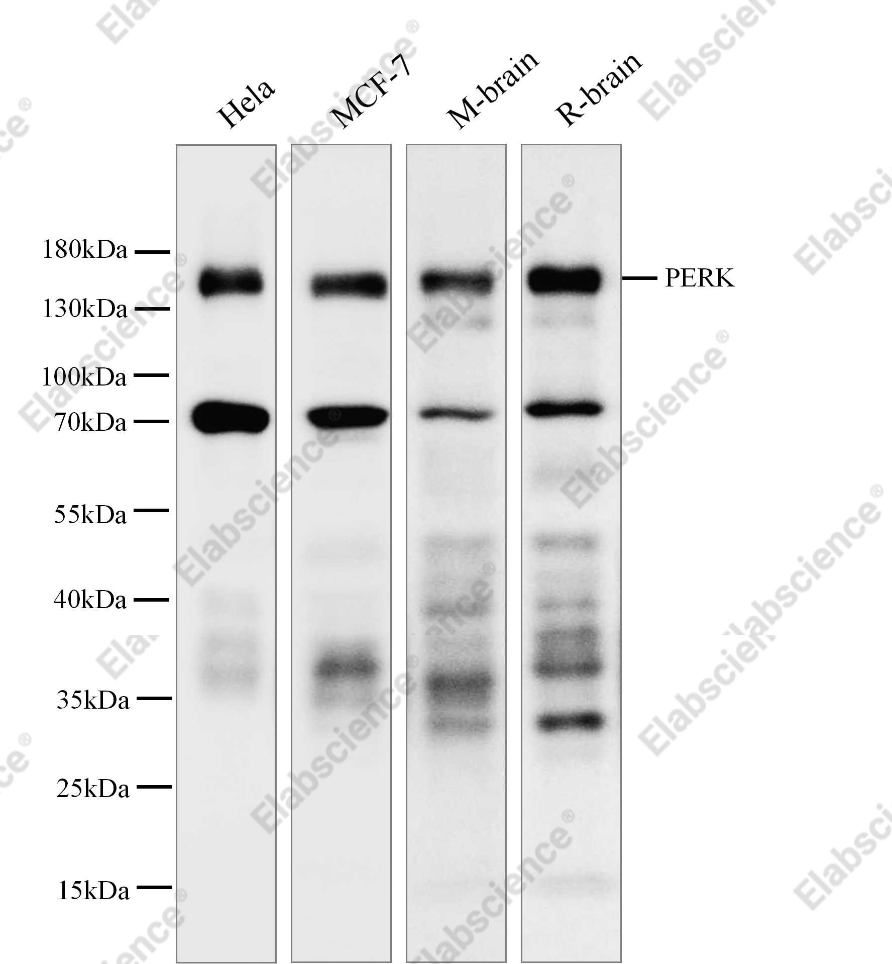 Recombinant PERK Monoclonal Antibody - 1