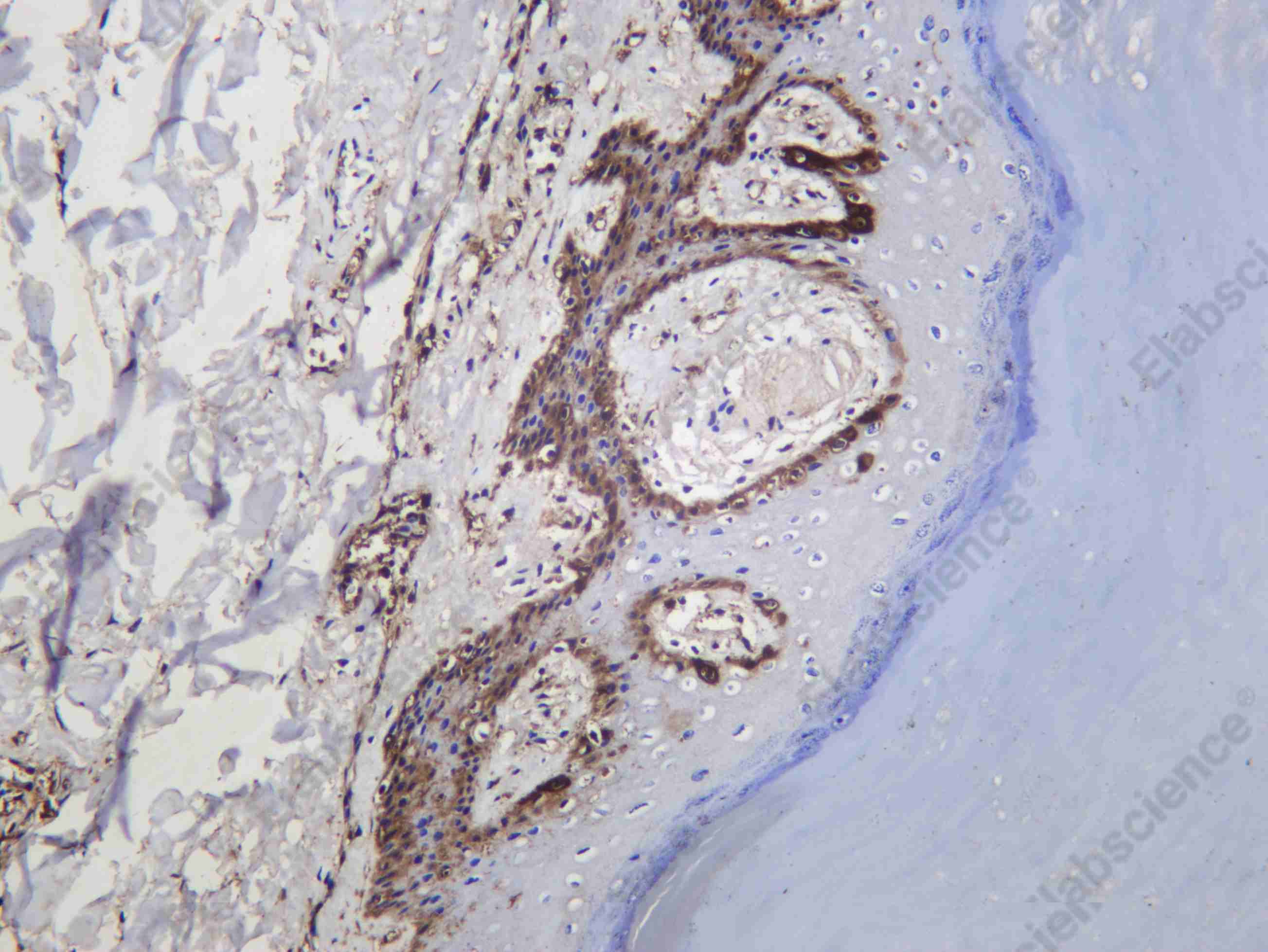 Recombinant PROF1 Monoclonal Antibody - 1