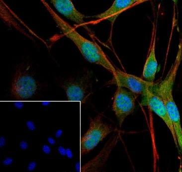 Recombinant Pin1 Monoclonal Antibody - small - 4