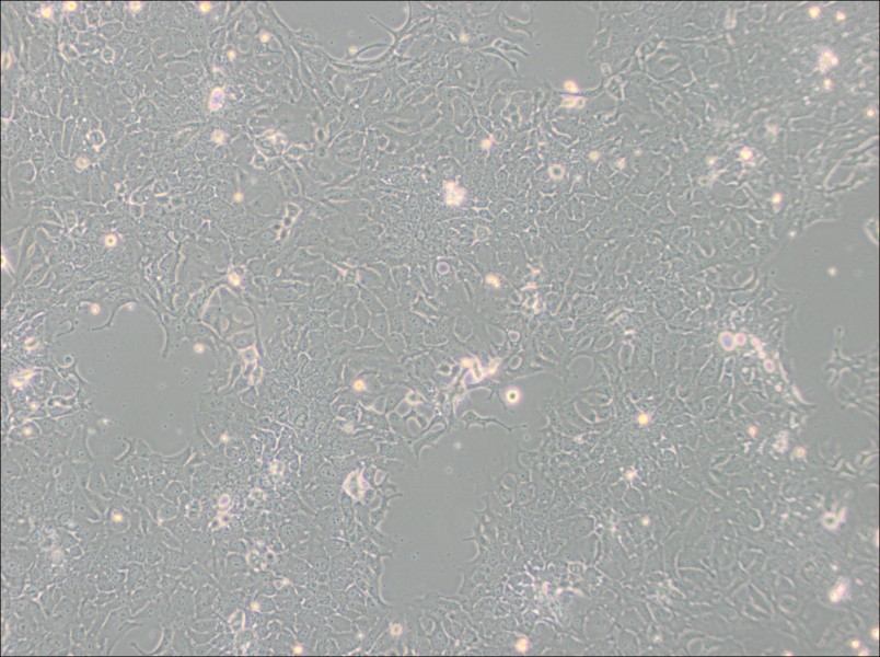 TE-10 Cell Complete Medium - 3