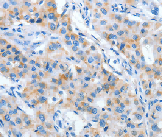 IMMT Polyclonal Antibody - 2