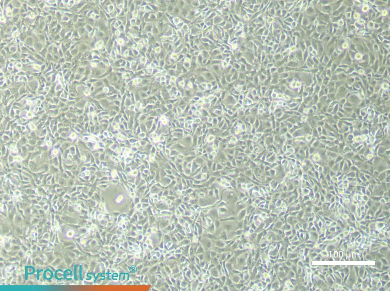 Rat Brain Microvascular Endothelial (Primary cell immortalization) Cell Complete MediumRat Brain Microvascular Endothelial (Primary cell immortalization) Cell Complete Medium - 1